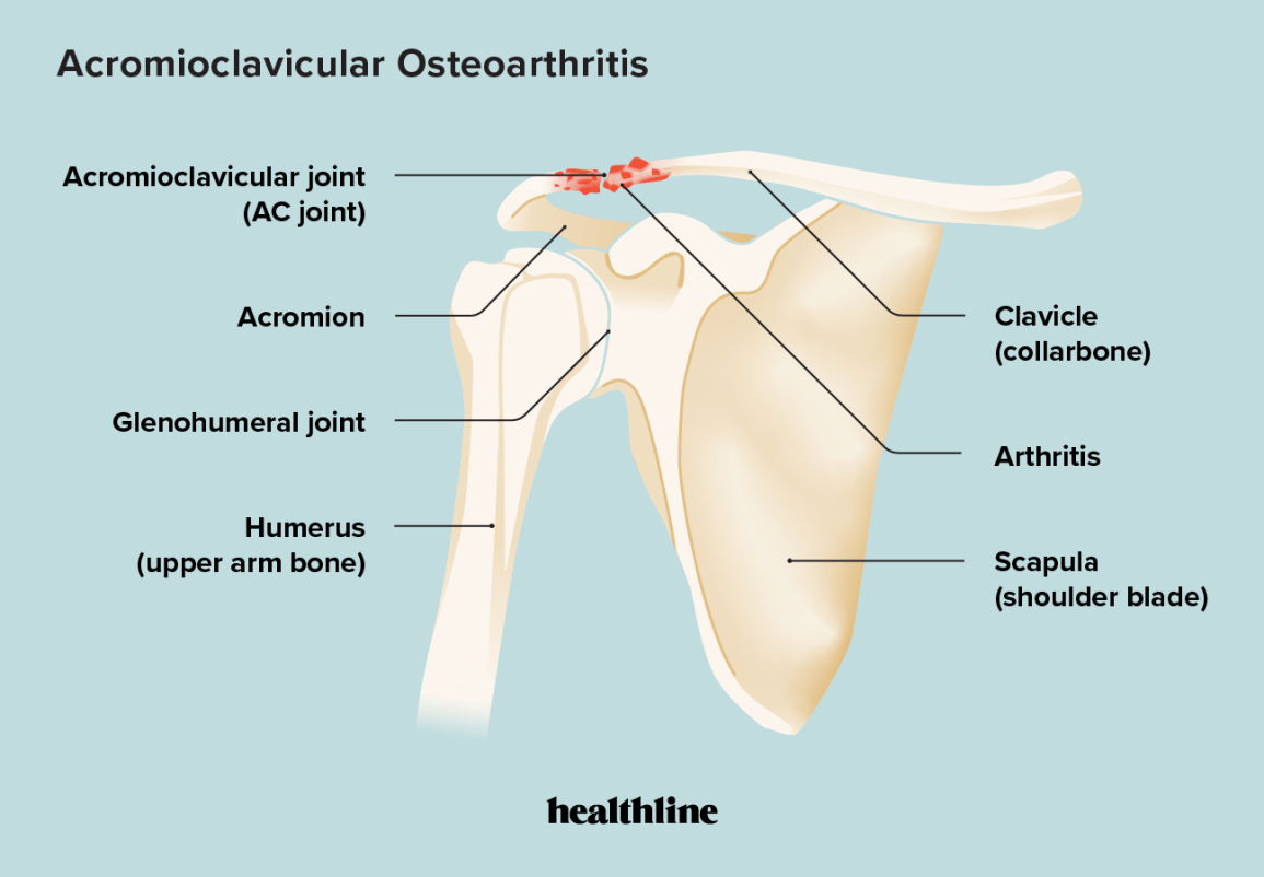 Omoplata. A escápula é um soquete da articulação do ombro, que ajuda muitos músculos e ligamentos a apoiar e estabilizar as articulações.
